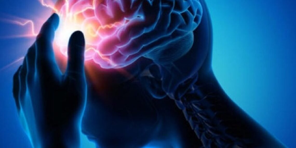 Fundación Epilepsia