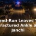 Hit-and-Run Leaves Teen With Fractured Ankle at Sero Janchi